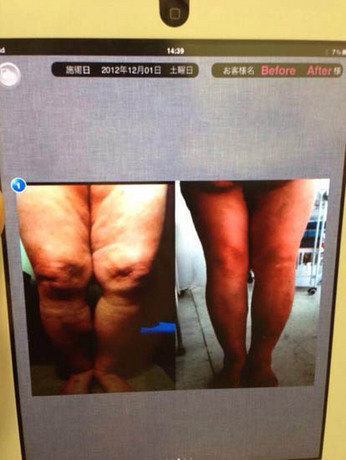 お知らせ 浮腫み.jpg